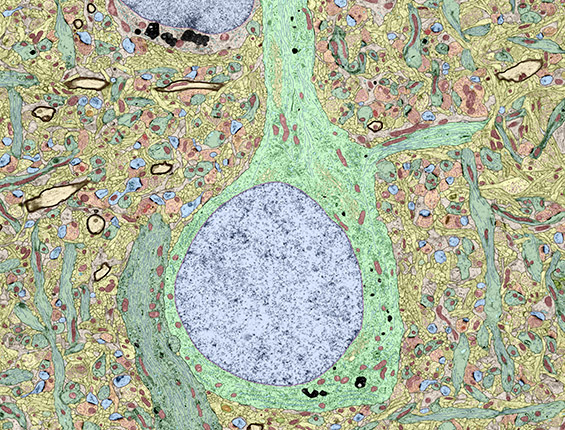 Golgi stain of a pyramidal neuron highlighting the arborised dendrites.